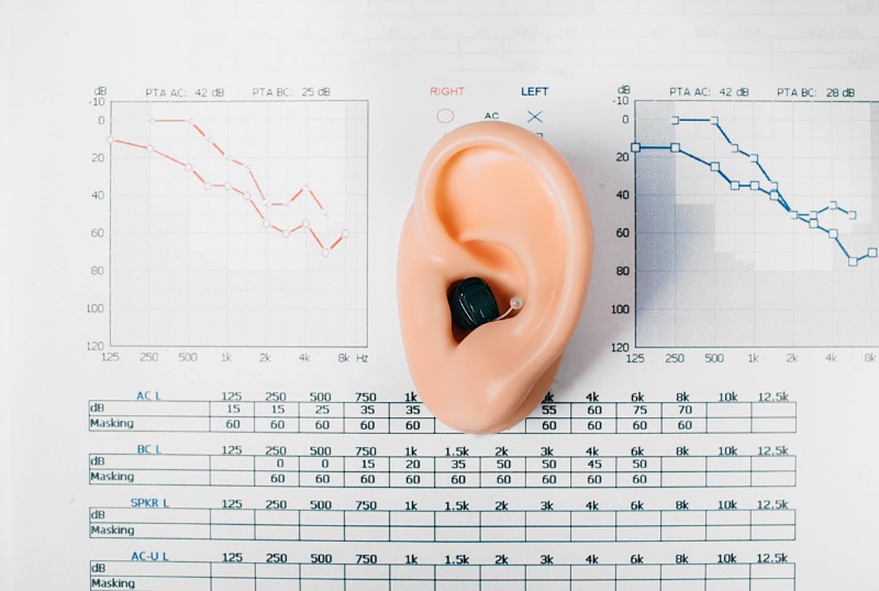 Lire la suite à propos de l’article Qu’est-ce qu’un audiogramme ?